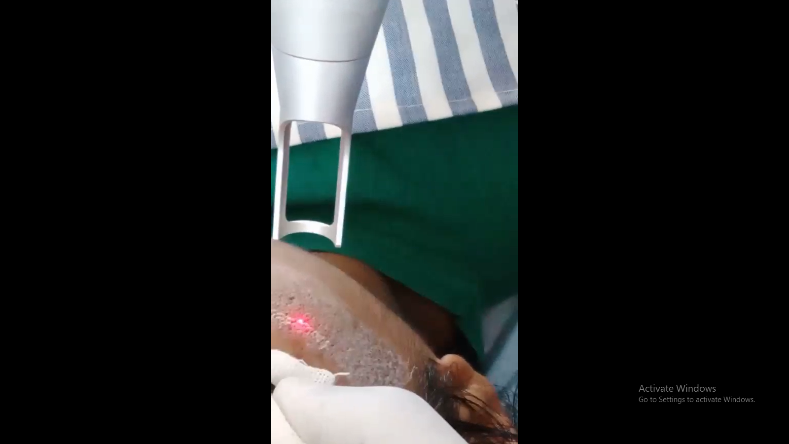Anti-Ageing Treatment